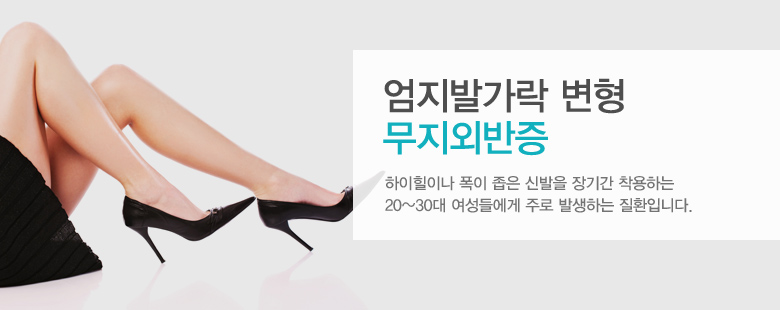 엄지발가락 변형 무지외반증